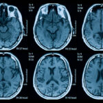 Affordable MRI in Delhi 2025: Price Guide for Brain & Body Scans